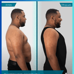 Vista frontal y posterior de faja de compresión masculina SlimForm Pro, diseño invisible bajo ropa